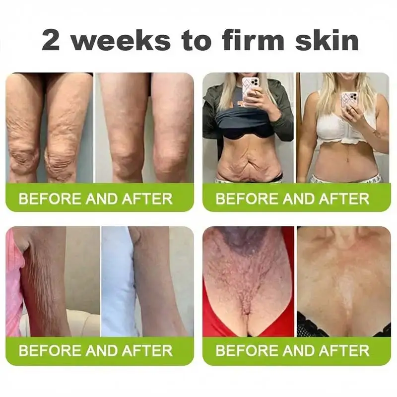 moringa & Vita-A Retinol Shot Wrinkle-Lift Tightening cream - Last Day Promotion 70% OFF - Image 8