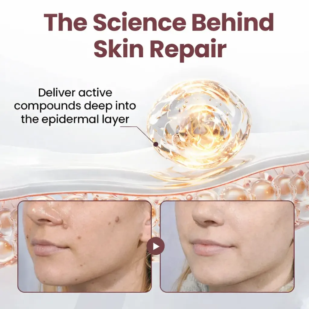 KeraErase Dual-Action Renewal Cream - Image 4