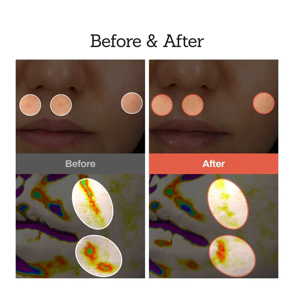 Retinal Skin Booster Serum - Image 6