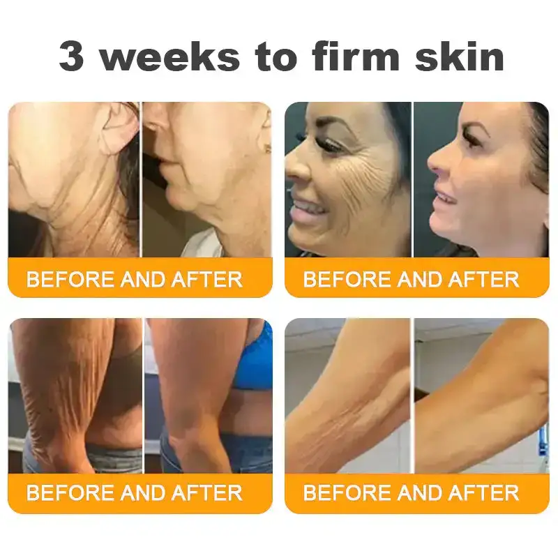 𝐁𝐞𝐞 𝐕𝐞𝐧𝐨𝐦 𝐀𝐥𝐥-𝐢𝐧-𝐎𝐧𝐞 𝐂𝐫𝐞𝐚𝐦–🌸 Anti-aging,Hydrating, Skin Repair, Even Tone, Acne and Dark Spot Treatment, Wart and Mole Removal, Psoriasis Relief - Image 6