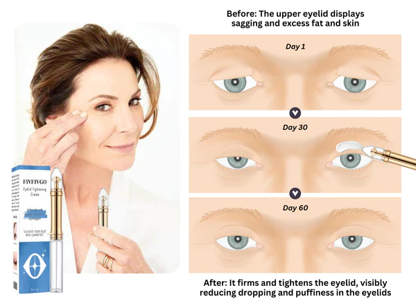 Eyelid Tightening Cream - Image 2