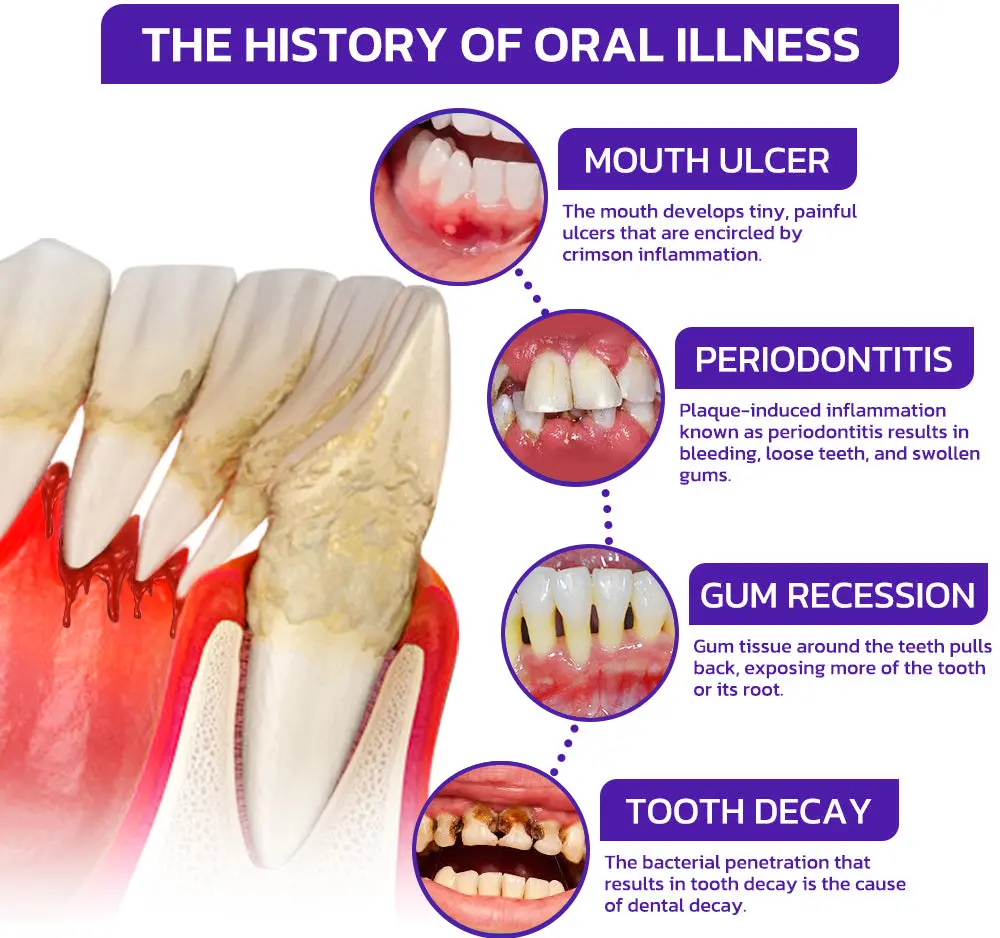 VioCore Dental Treatment Toothpaste - Image 6