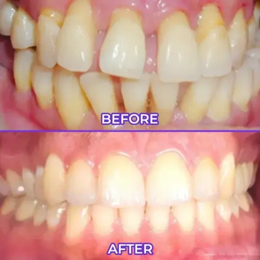 SensiGum Fluoride Toothpaste - Image 2
