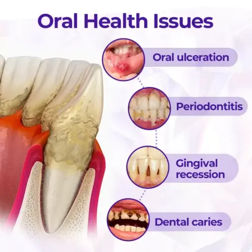 SensiGum Fluoride Toothpaste - Image 9