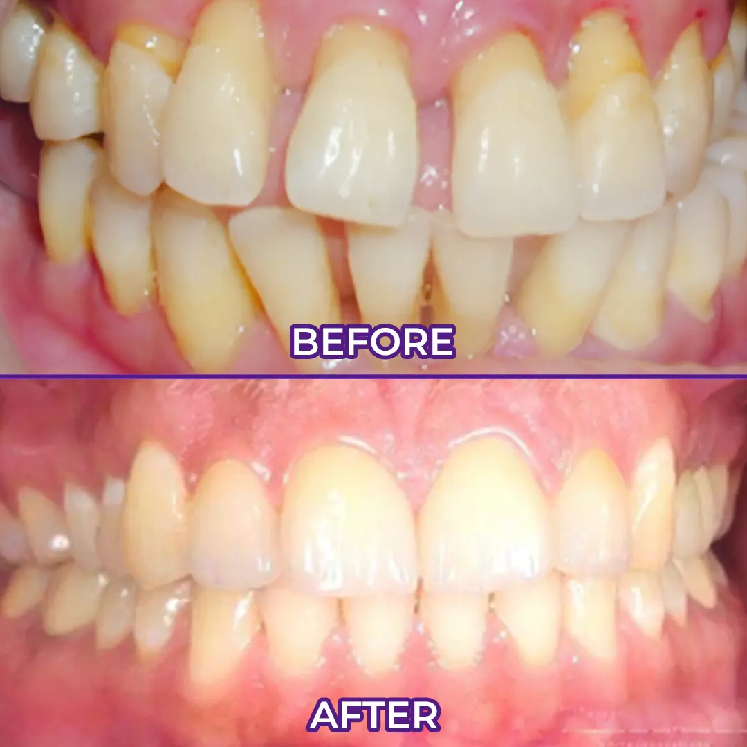 VioletX Advanced Whitening Complex - Image 3