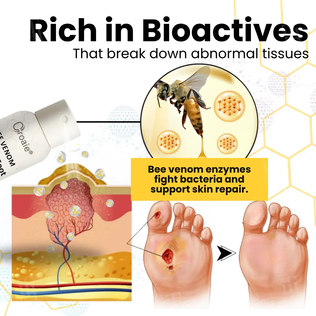 Bee Venom Diabetic Foot Ulcer Spray - Image 5