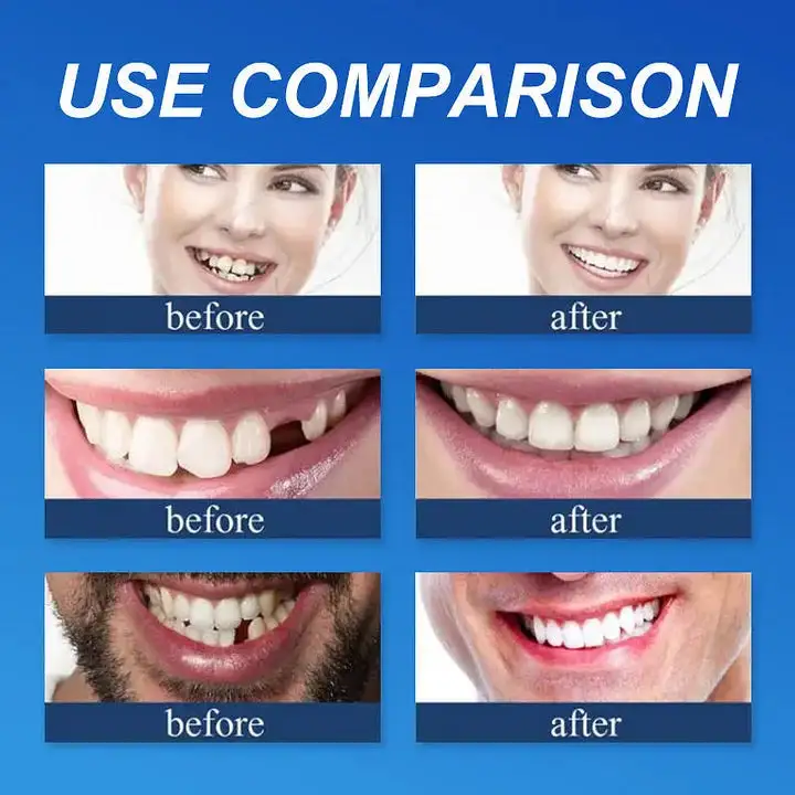 🌎Ends Today: 70% OFF! Medical Full Denture with Strong Suctiond - Image 6