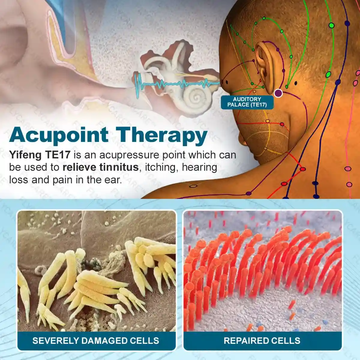 TinniCalm Tinnitus Treatment Ear Patch - Image 5