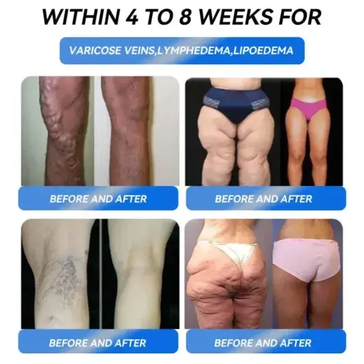 Weight Loss Oral Solution - Image 5