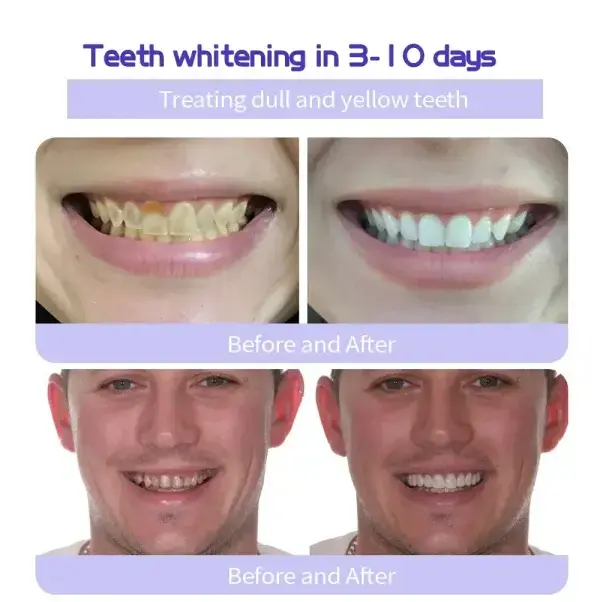 Teeth Restoration Mineral Powder - Image 10