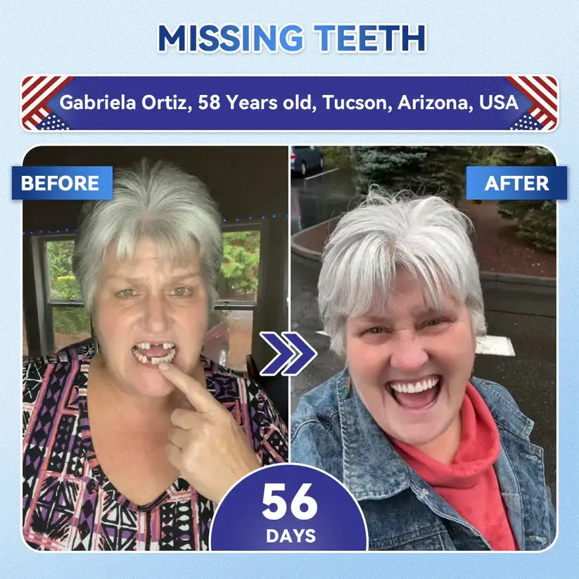 𝟓-𝒊𝒏-𝟏 𝑻𝒊𝒅𝒆𝒈𝒍𝒖𝒔𝒊𝒃 𝑻𝒐𝒐𝒕𝒉 𝑶𝒓𝒂𝒍 𝑺𝒕𝒓𝒊𝒑𝒔 & Gum Repair Oral Strips - Image 4