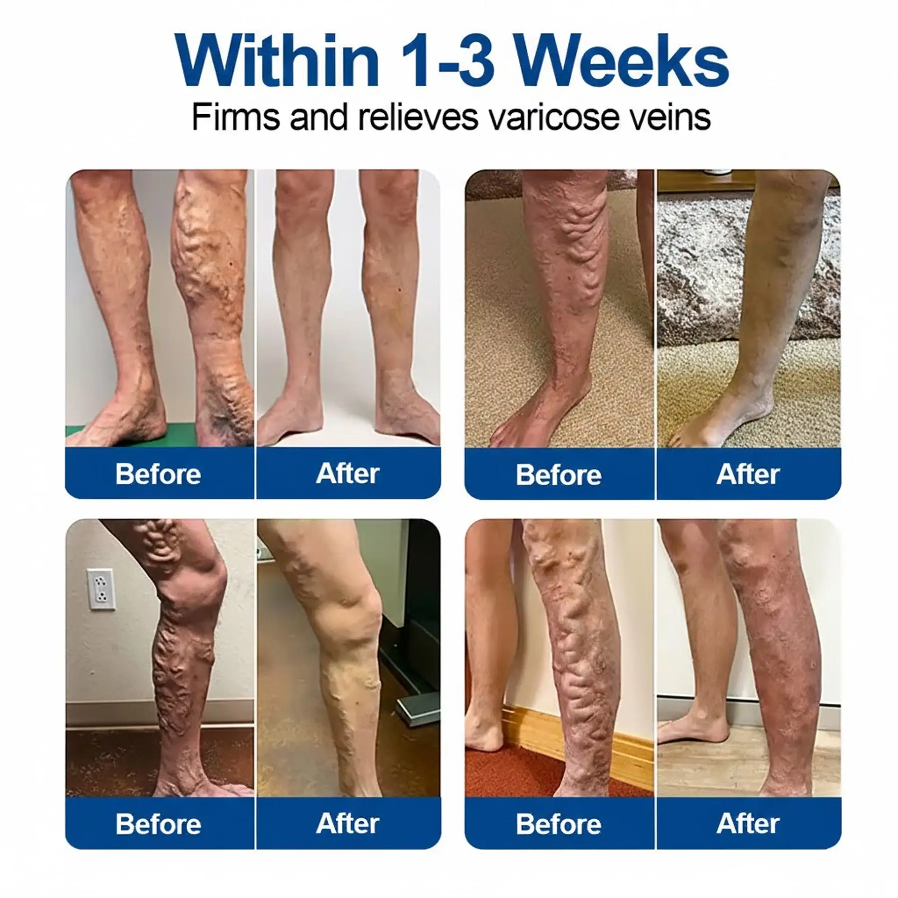 Vein Ease Microneedle Patch - Image 3