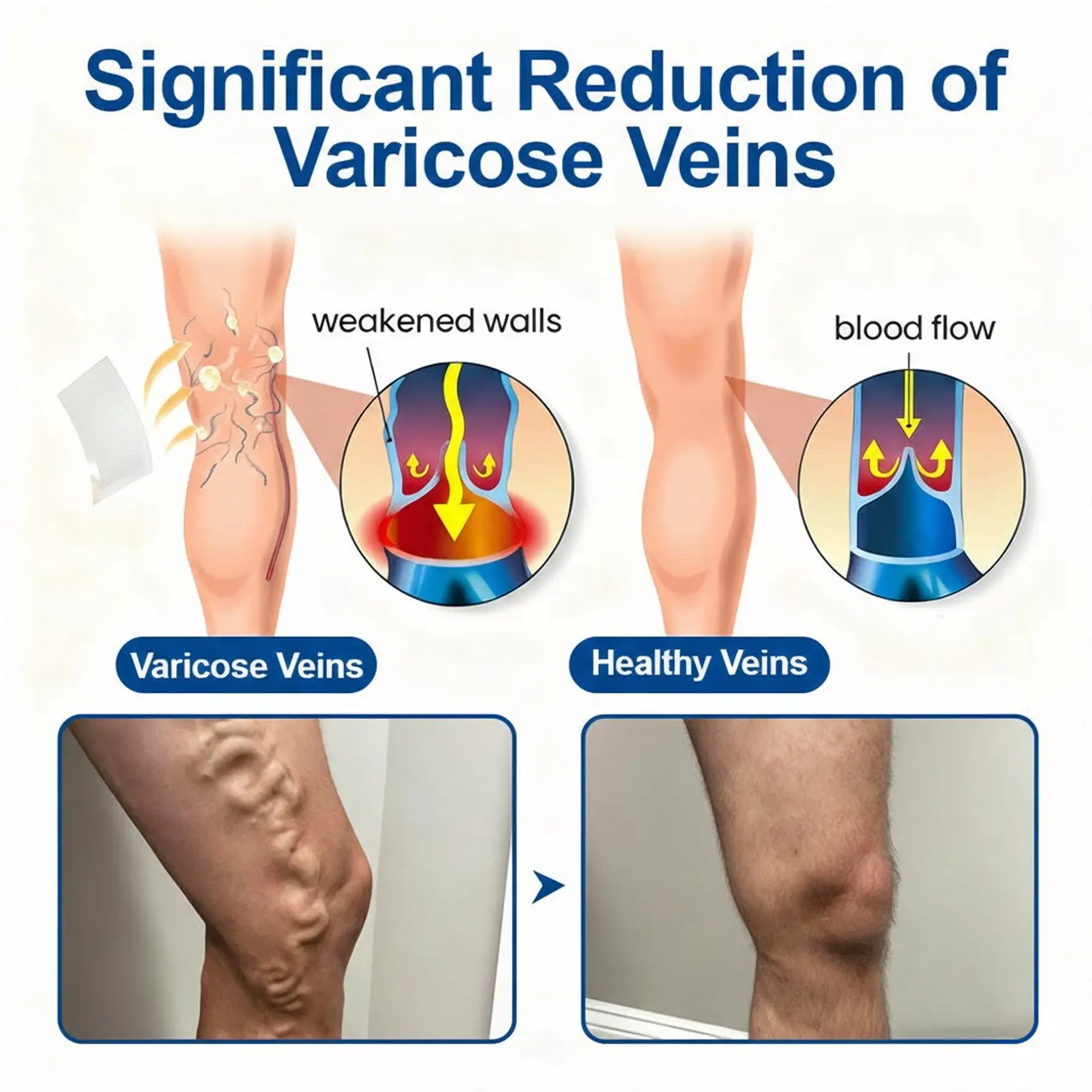 Vein Ease Microneedle Patch - Image 4