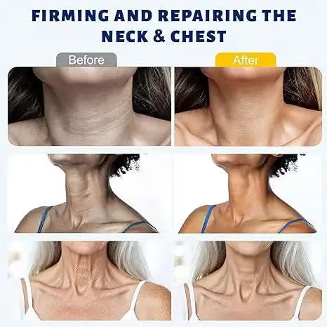 Juxek Neck Firming Cream Reduces Wrinkles and Double Chin - Five Rollers for All Around Massage - Image 5