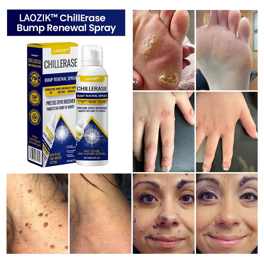 ChillErase Bump Smoothing Micro-Mist - Image 6