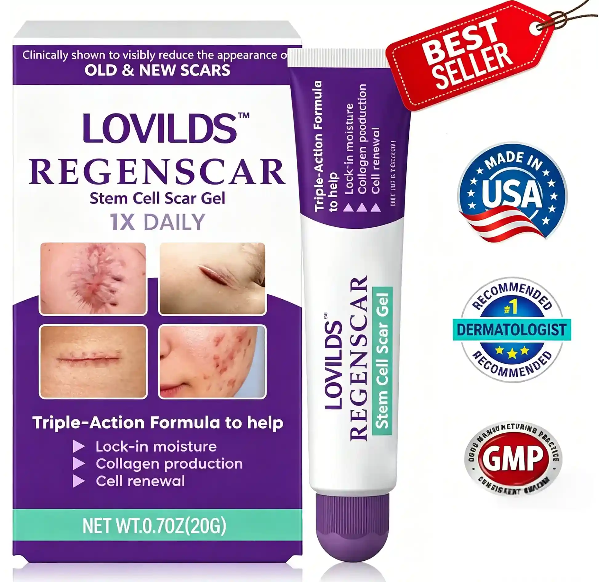 ReGenScar Stem Cell Repair Gel