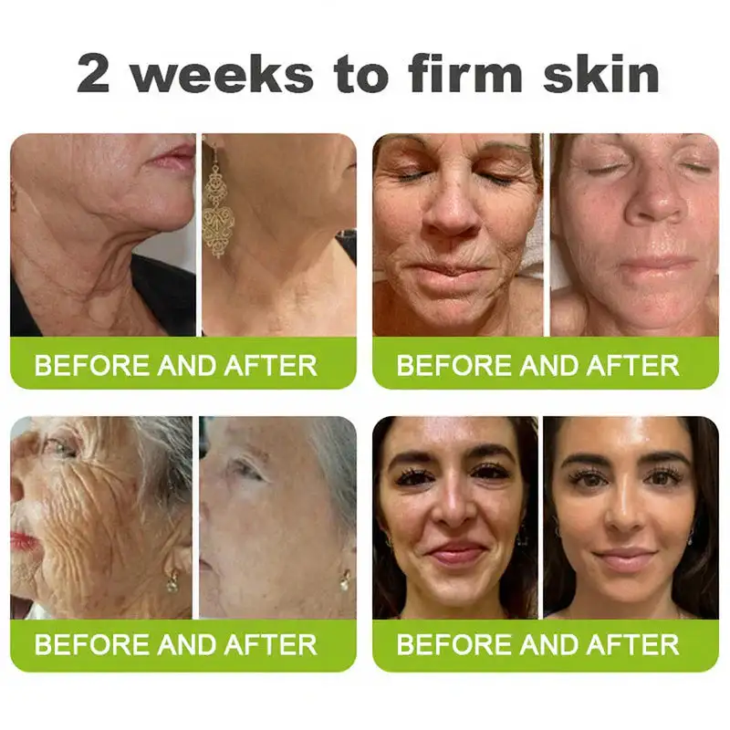 Botin & Vita-A Retinol Shot Wrinkle-Lift Tightening Cream - Image 8
