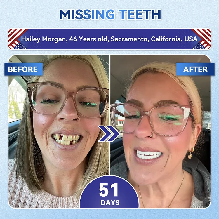 Tideglusib Fast‑Dissolving Tooth & Gum Repair Oral Strips - Image 2