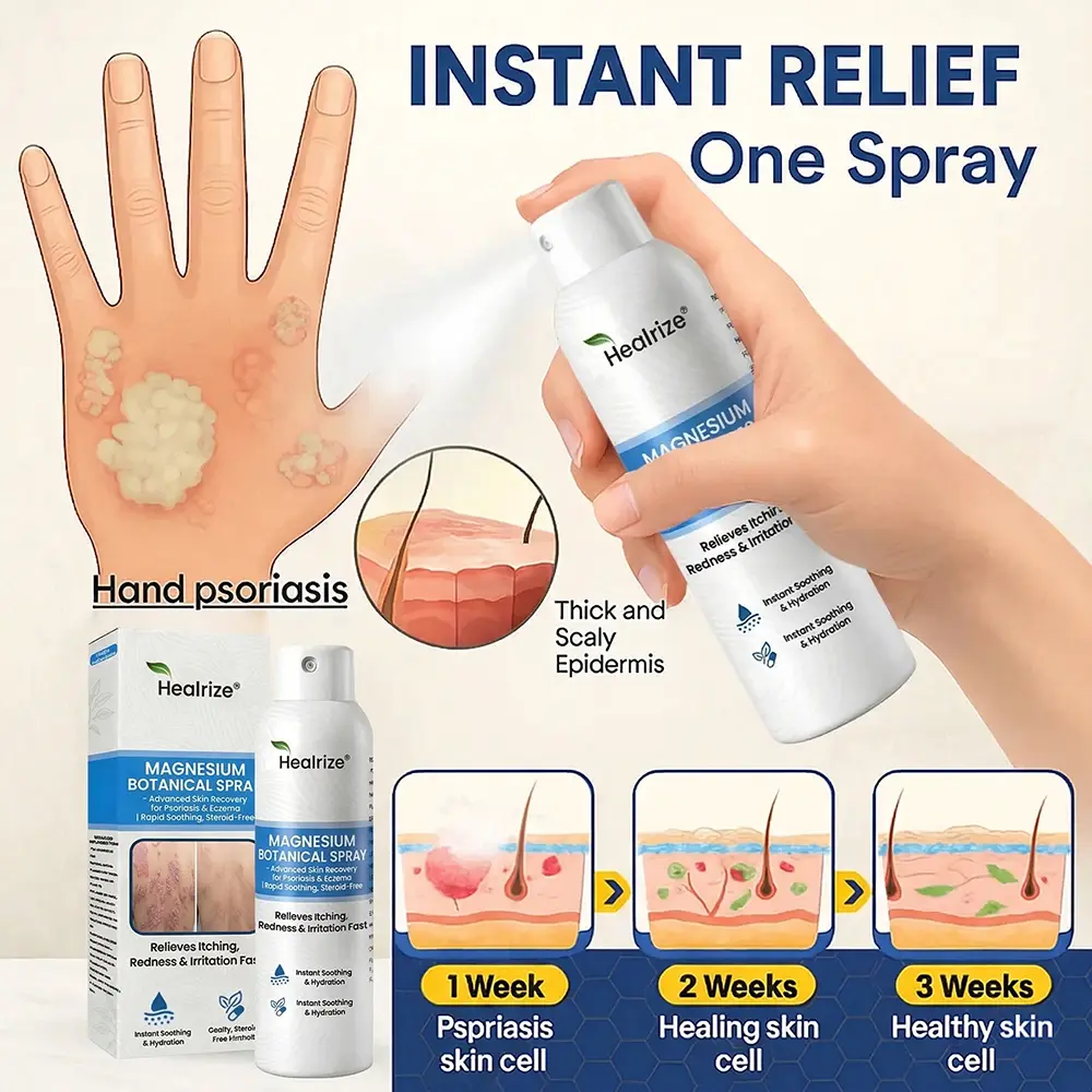 Magnesium Botanical Spray – Advanced Skin Recovery for Psoriasis & Eczema - Image 10
