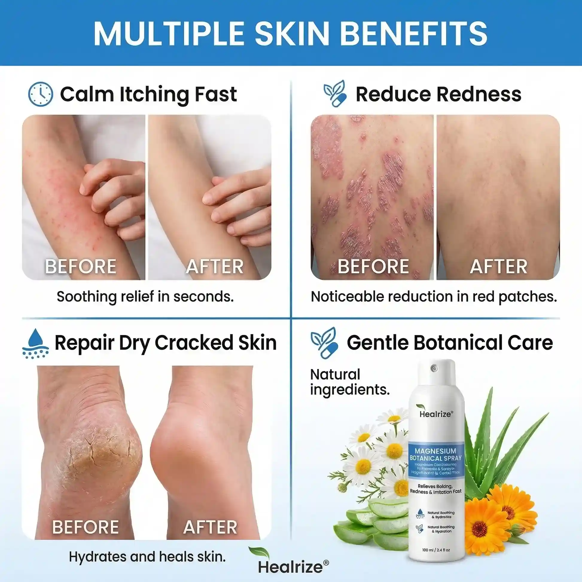 Magnesium Botanical Spray – Advanced Skin Recovery for Psoriasis & Eczema - Image 9