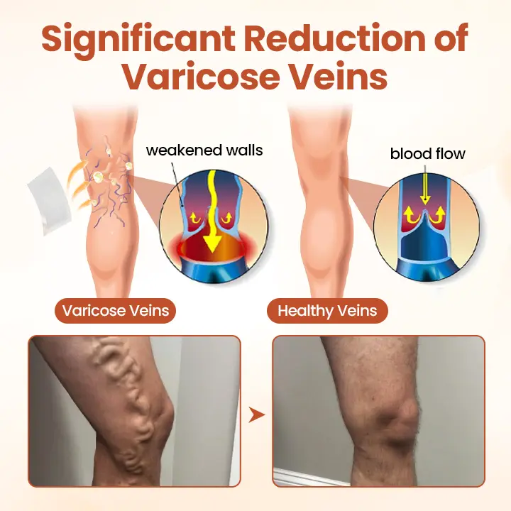 VeinTarget Microneedle Patch - Image 4