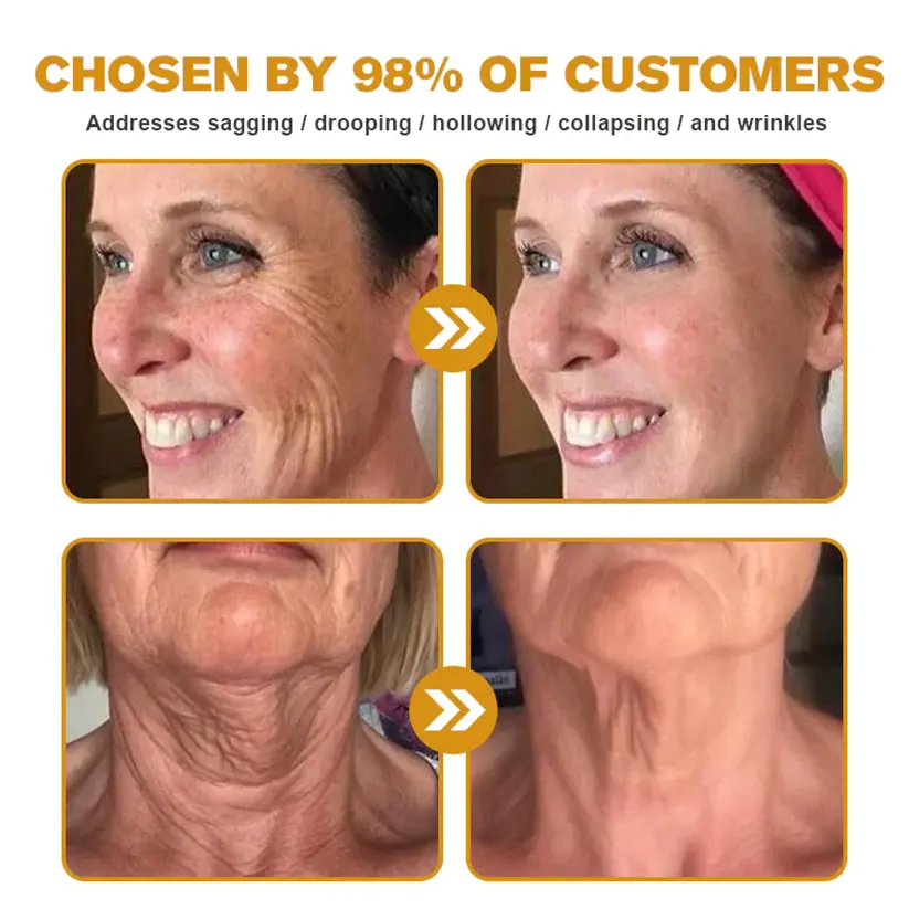USA’s #1 Bee Venom Skin Restoration Cream - Image 3