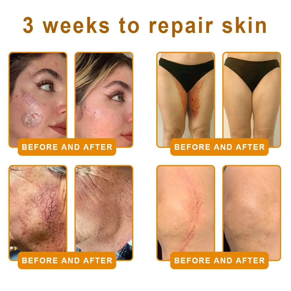USA’s #1 Bee Venom Skin Restoration Cream - Image 8