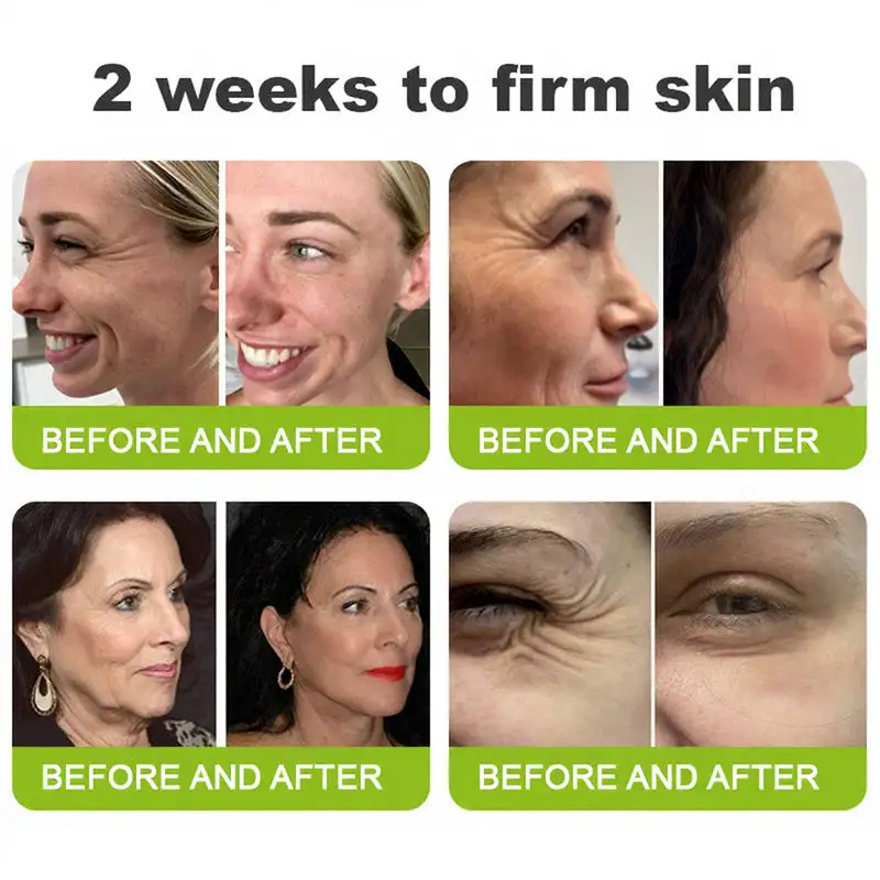 Retinol Shot: Firm & Lift - Image 6