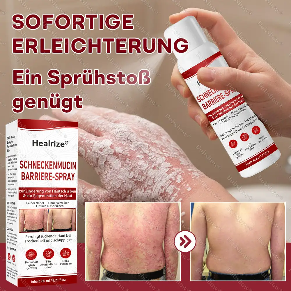 Schneckenmucin-Barriere-Spray zur Linderung von Hautschüben und zur Regeneration der Haut-𝘿𝙚𝙪𝙩𝙨𝙘𝙝𝙡𝙖𝙣𝙙𝙨 𝙉𝙧. 1 𝙨𝙥𝙧ü𝙝𝙗𝙖𝙧𝙚 𝘽𝙖𝙧𝙧𝙞𝙚𝙧𝙚-𝙋𝙛𝙡𝙚𝙜𝙚 𝙗𝙚𝙞 𝙋𝙨𝙤𝙧𝙞𝙖𝙨𝙞𝙨 - Image 2