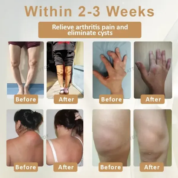 Emu Oil Turmeric Bone Sooth Gel - Image 2