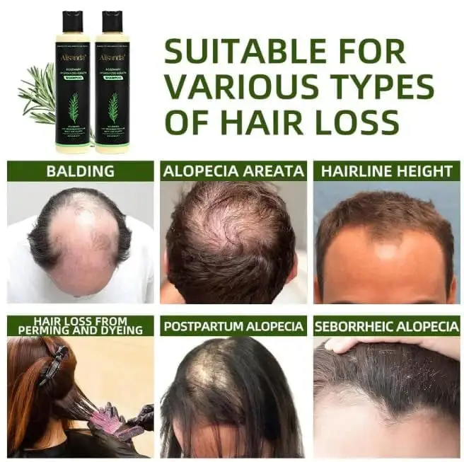 Organic Rosemary Hair Growth Shampoo - Image 5