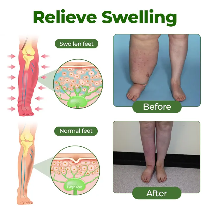 Professional Leg Circulation Cream - Image 5